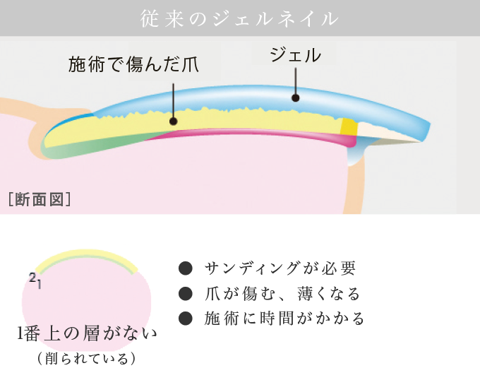 従来のジェルネイル